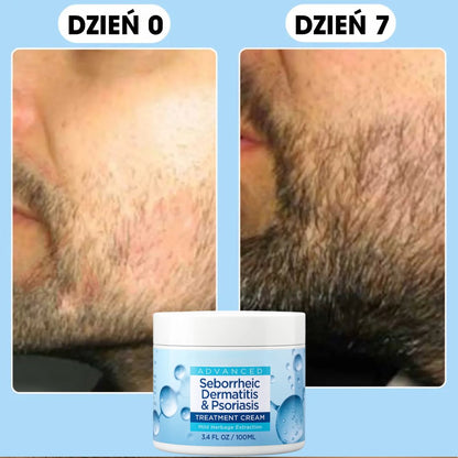 BeardCalm™ – Kojący krem na brodę